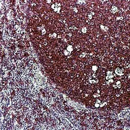 Anti-CD20 antibody [L26] used in IHC (Paraffin sections) (IHC-P). GTX29475